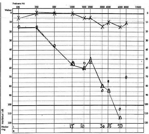 Audiogram